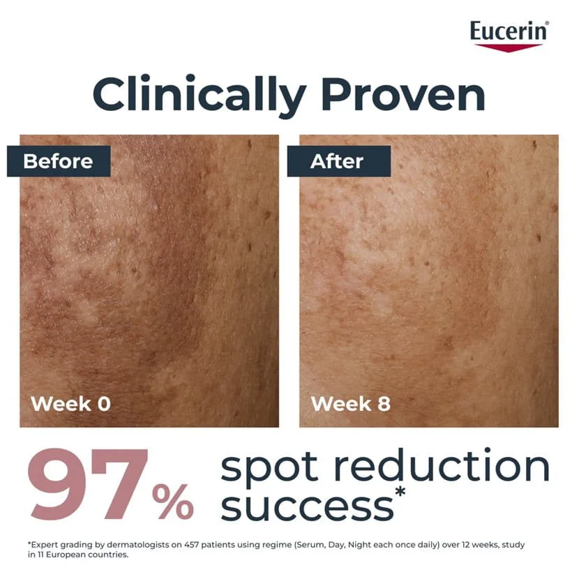 Eucerin Anti-Pigment Day Cream SPF 30 - Image 3